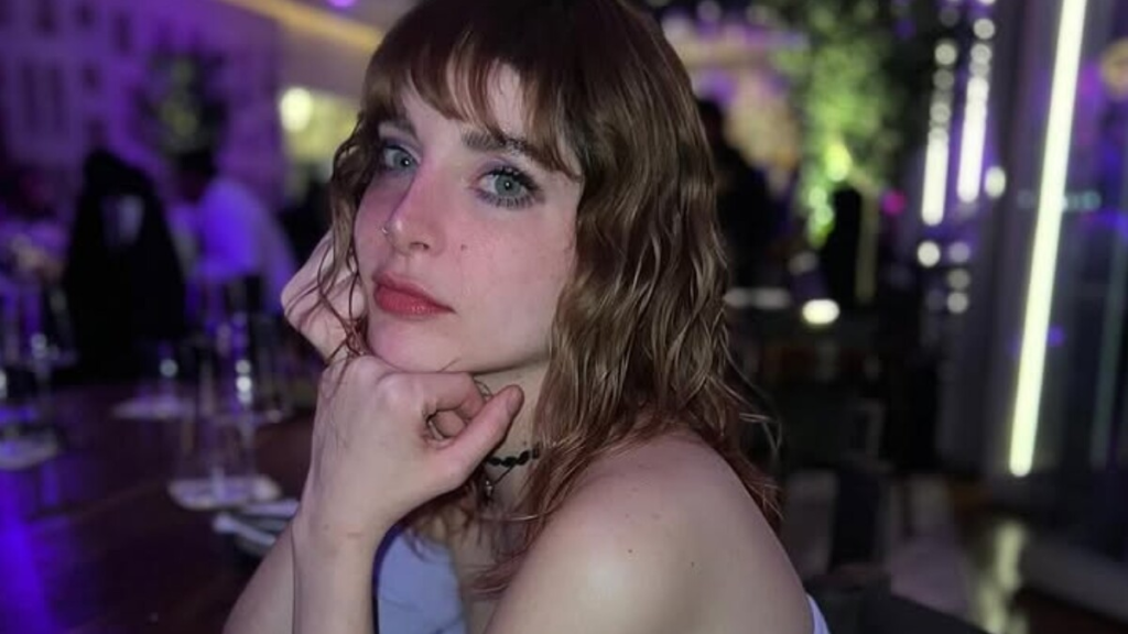 ¡Imelda Tuñón reaparece con un moretón! ¿Qué fue lo que le pasó?